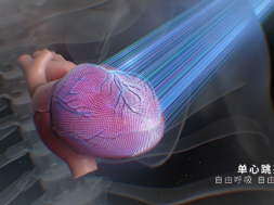 NeuVizEpoch+无极系列CT